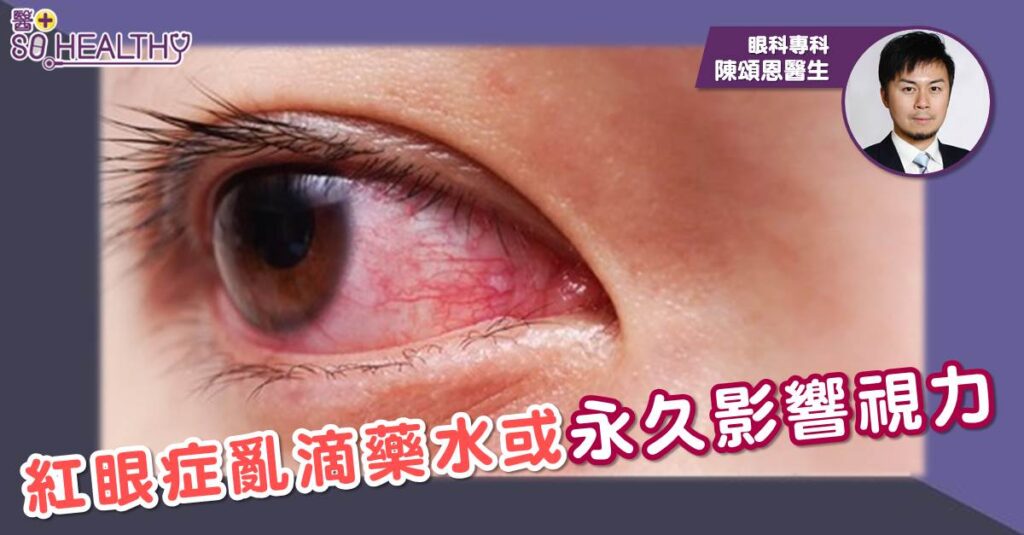 紅眼症亂滴藥水或永久影響視力