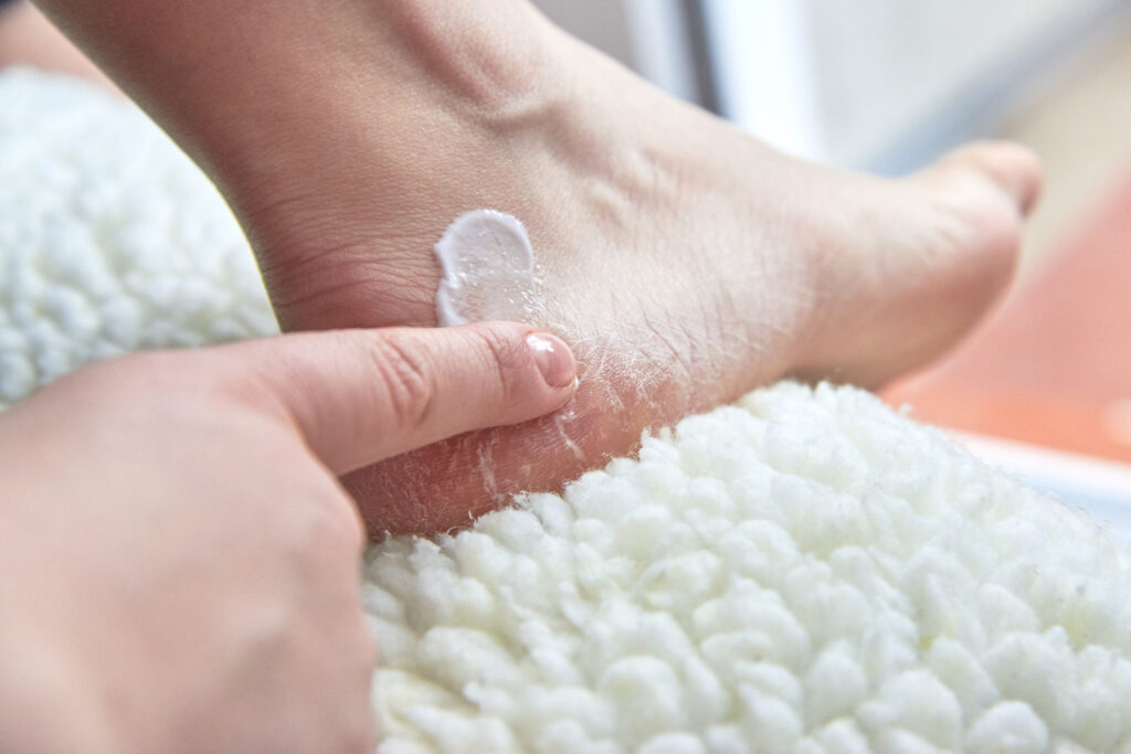 手踭腳踭都會是身體乾燥首先遭殃的位置，表層皮膚乾裂，鞋颯颯，經常要密密搽潤膚膏。