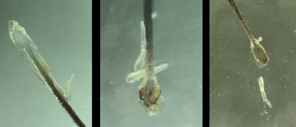 Demodex 顯微鏡下的蠕形螨蟲。