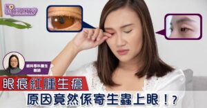 眼痕紅腫生瘡 原因竟然係寄生蟲上眼!