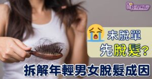 未脱單 先脱髮 拆解年輕男女脫髮成因