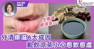 飲涼茶就可以KO痱滋? 小心愈飲愈虛