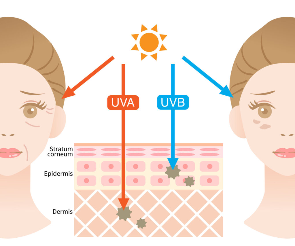 UVA & UVB 分別會曬傷皮膚及導致皮膚變黑、變老及出皺紋。
