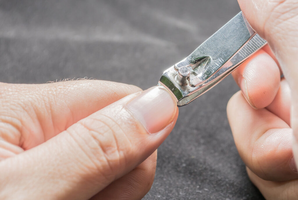 剪指甲剪得太短，可能會令後來長出的指甲更彎曲，插入指甲兩側皮肉。