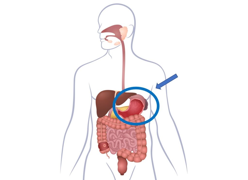 脾胃為一身氣機的樞，主運化 、升清及統血。