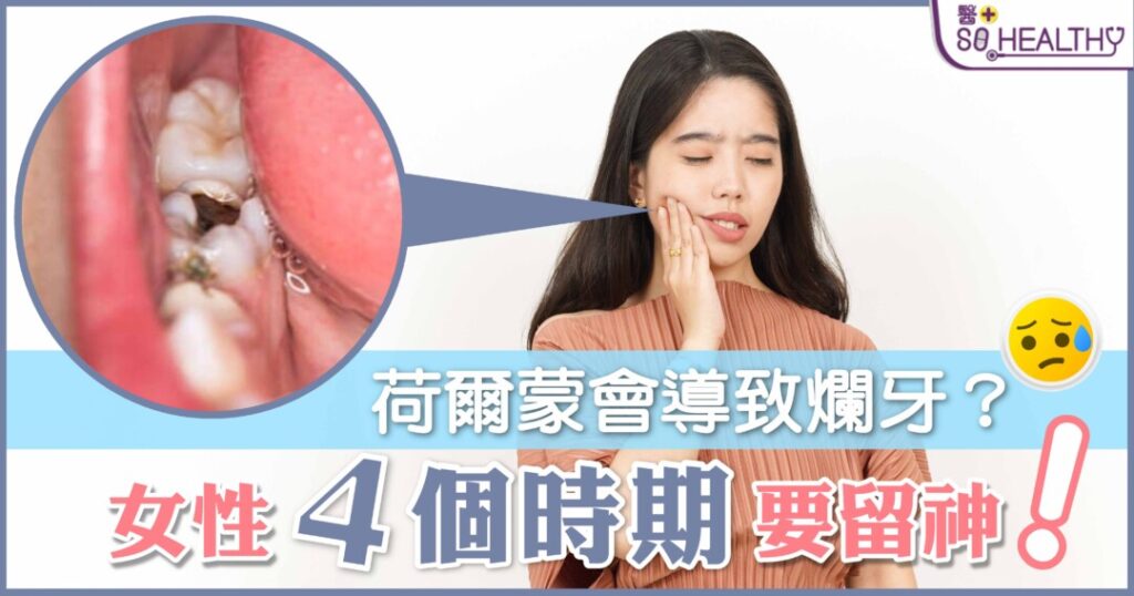 女性荷爾蒙竟然還跟牙齒健康有關？女性荷爾蒙的水平會在不同時期有所變化，也許你知道荷爾蒙變化會影響身體，包括情緒、皮膚、睡眠等，但你未必知道當荷爾蒙激增時，還有可能會令牙齦變得敏感，增加患上牙周病的機會！到底荷爾蒙如何影響牙齒？女性甚麼時候要特別注意口腔健康？荷爾蒙激增會引起甚麼牙齦疾病？