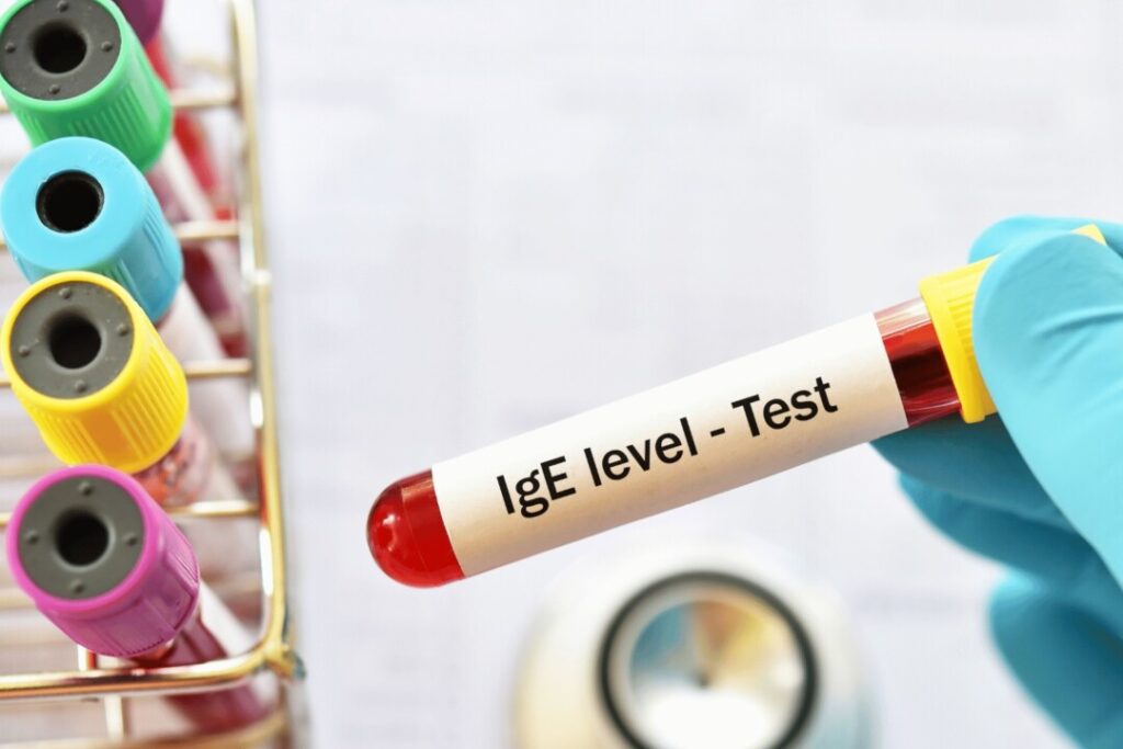 血液過敏測試有助準確找出濕疹過敏原