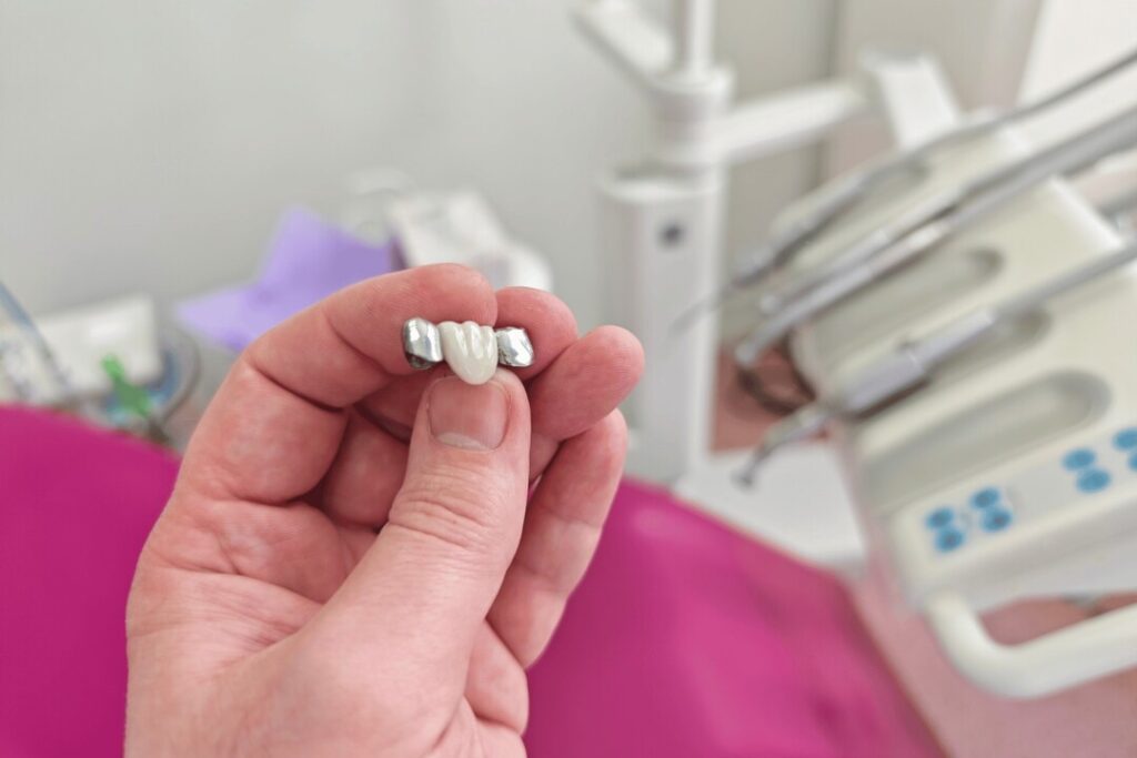 製作牙套通常需要多個步驟,有需要應尋求牙醫意見