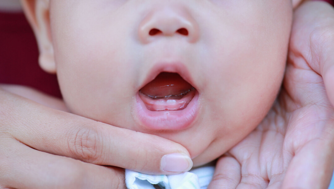兒童牙齒問題：在寶寶長出乳牙後，每天都要輕輕使用小軟毛牙刷和約一顆米大小的含氟牙膏為寶寶刷牙兩次。