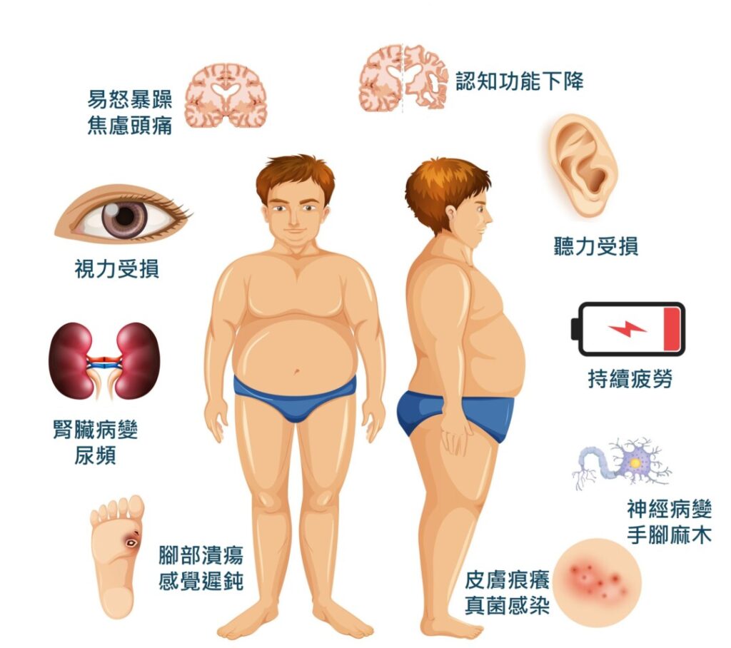 糖尿病併發症對職業司機的影響是多方面的，因此如何在長時間駕駛中保持穩定的血糖管理，就成為確保行車安全的關鍵。