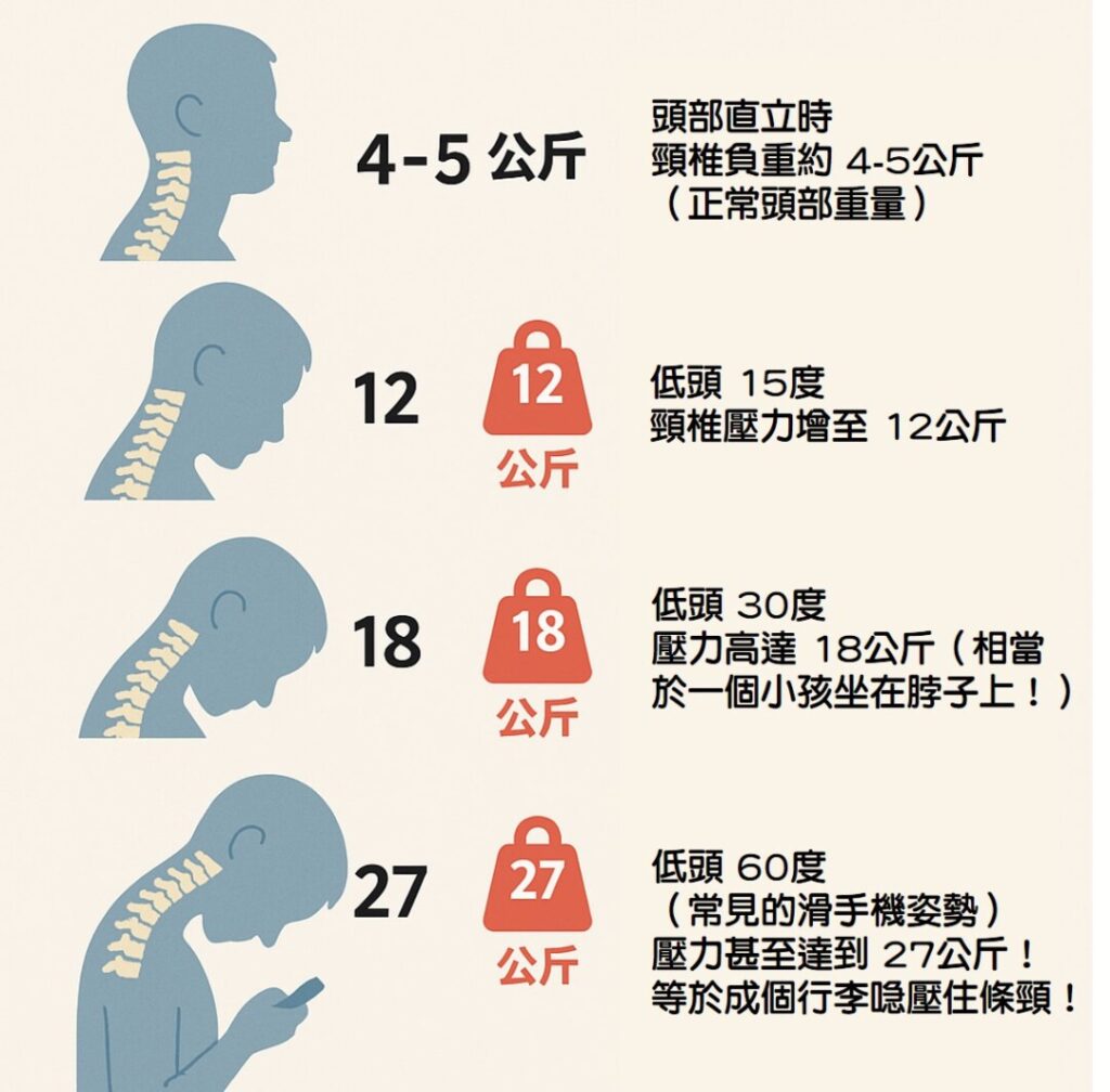 為什麼低頭族頸椎會受傷害？因為一低頭＝27kg壓力？等於成個行李喼壓住條頸！