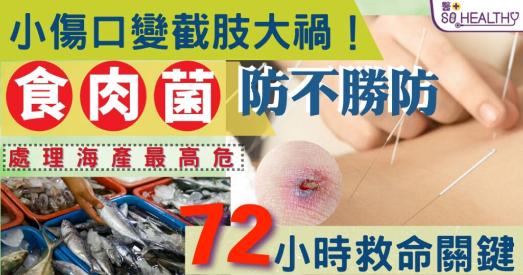 【小傷口變截肢大禍？！「食肉菌」72 小時奪命】