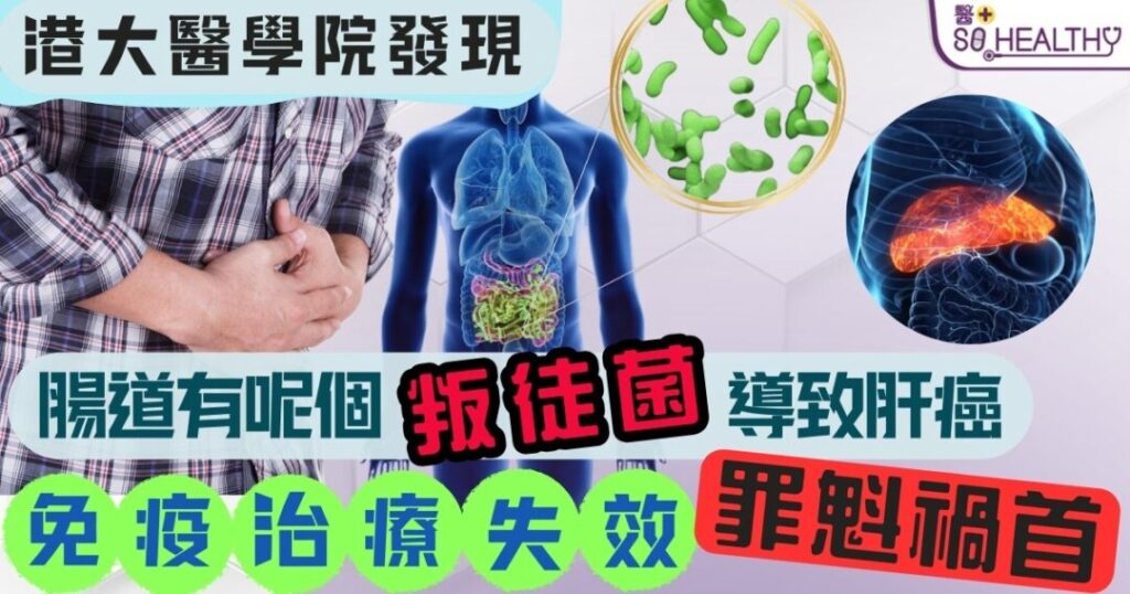 原來是腸道細菌在「拆台」！港大證實這「叛徒」削弱肝癌免疫治療火力