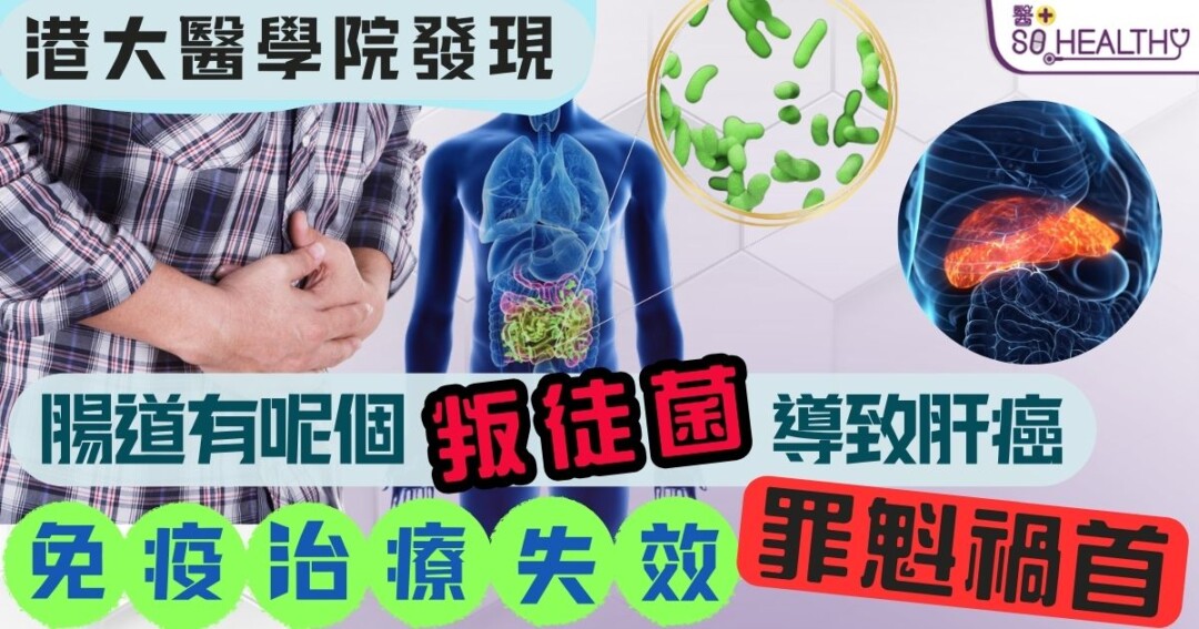 原來是腸道細菌在「拆台」！港大證實這「叛徒」削弱肝癌免疫治療火力