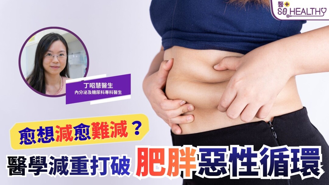 為何愈想減卻愈難減？ 肥胖的惡性循環，只是意志力不足嗎？