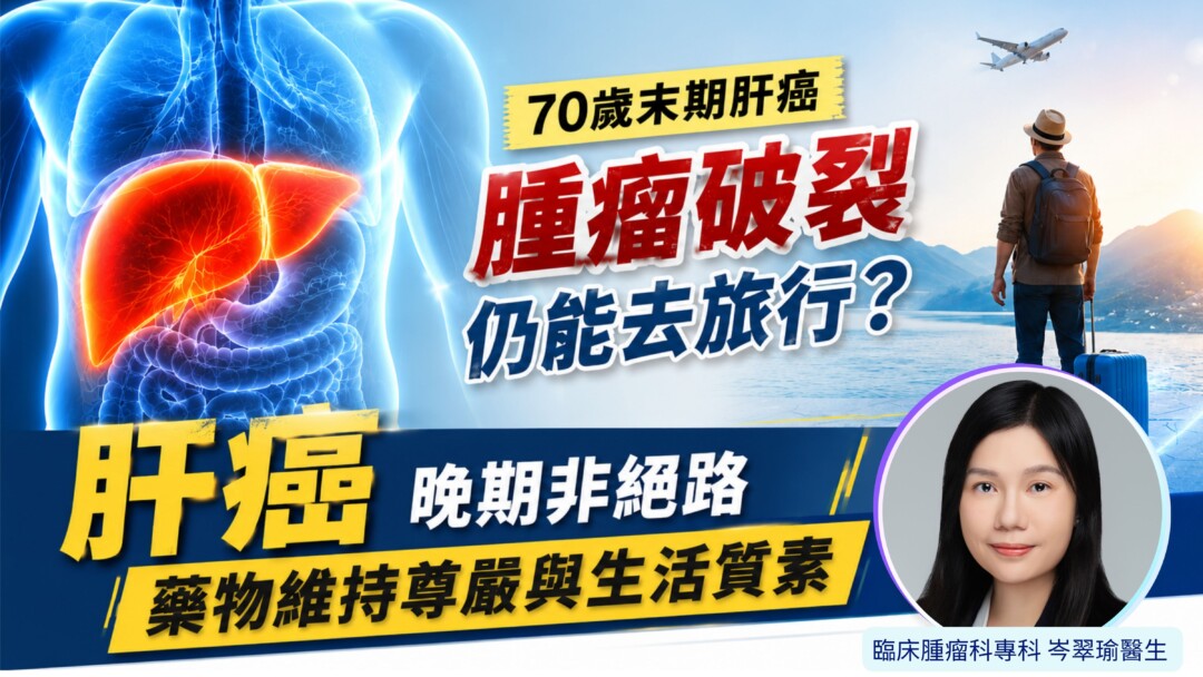 70歲末期肝癌腫瘤破裂仍能去旅行？ 晚期非絕路 藥物維持尊嚴與生活質素